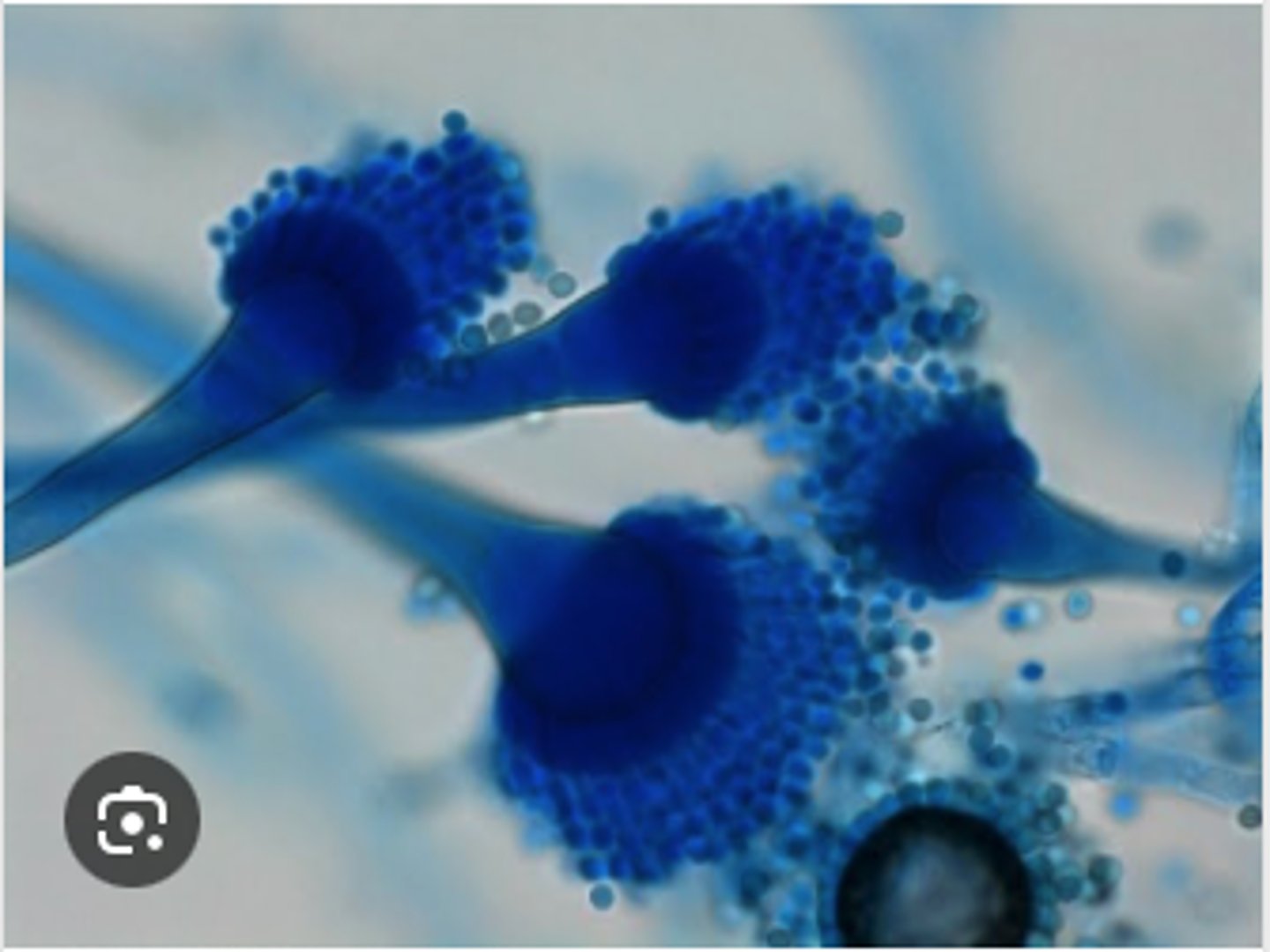 <p>A 4-year-old German Shepherd presents with chronic unilateral nasal discharge and sneezing. Rhinoscopy reveals fungal plaques. Culture grows blue-green Aspergillus colonies, and a tape mount shows conidiophores with vesicles and phialides producing chains of conidia.</p>