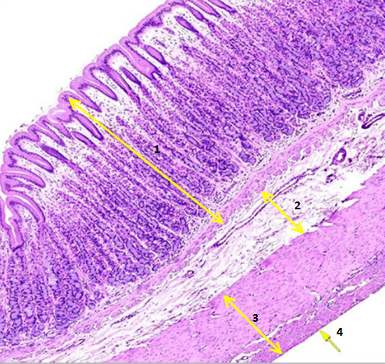 <p>ID the Histology</p>
