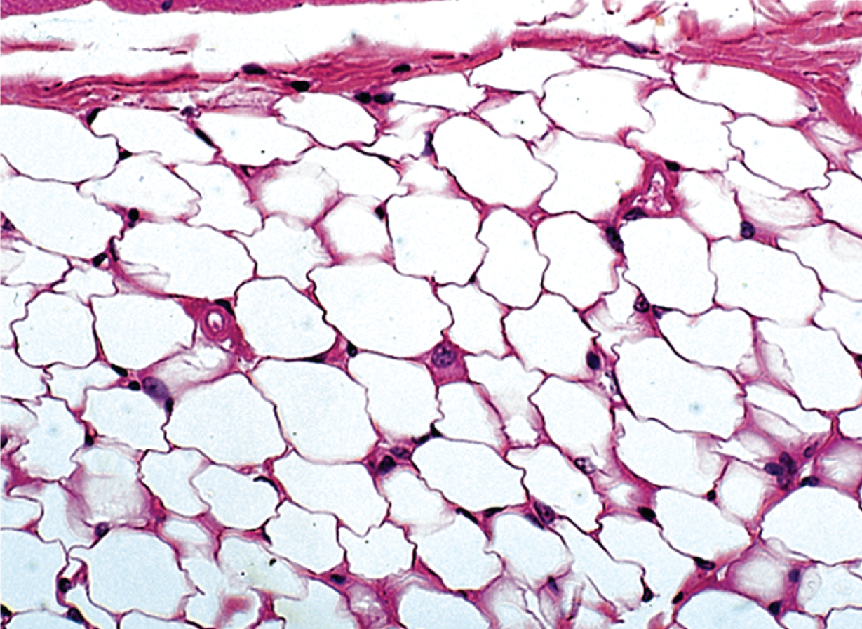 <p>Fat tissue; contains adipocytes, areolar tissue, reticular tissue, and blood capillaries; the body’s main energy reservoir </p>
