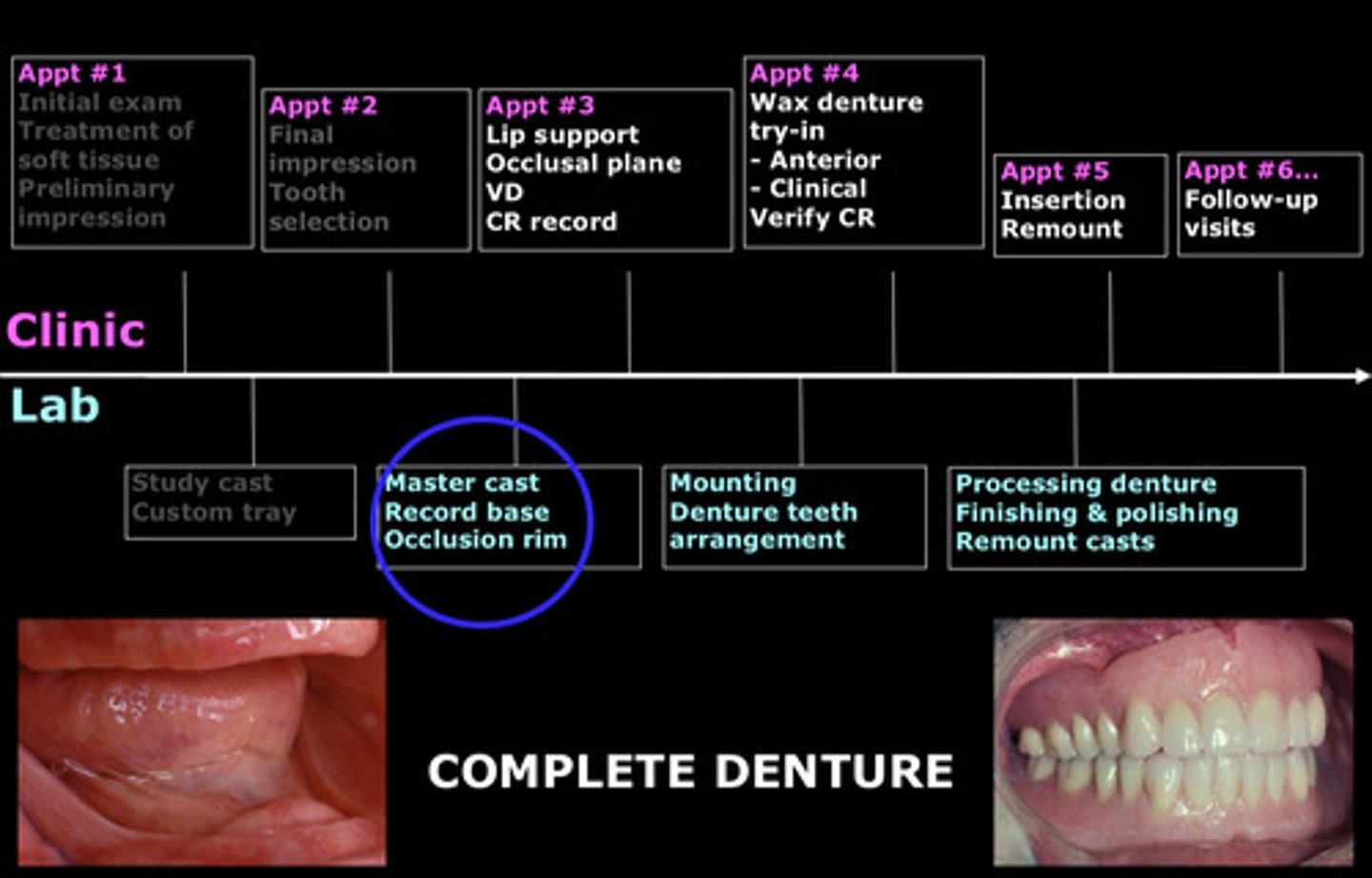 <p>after the jaw relations have been taken in the patient's mouth; no jig in the real world</p>