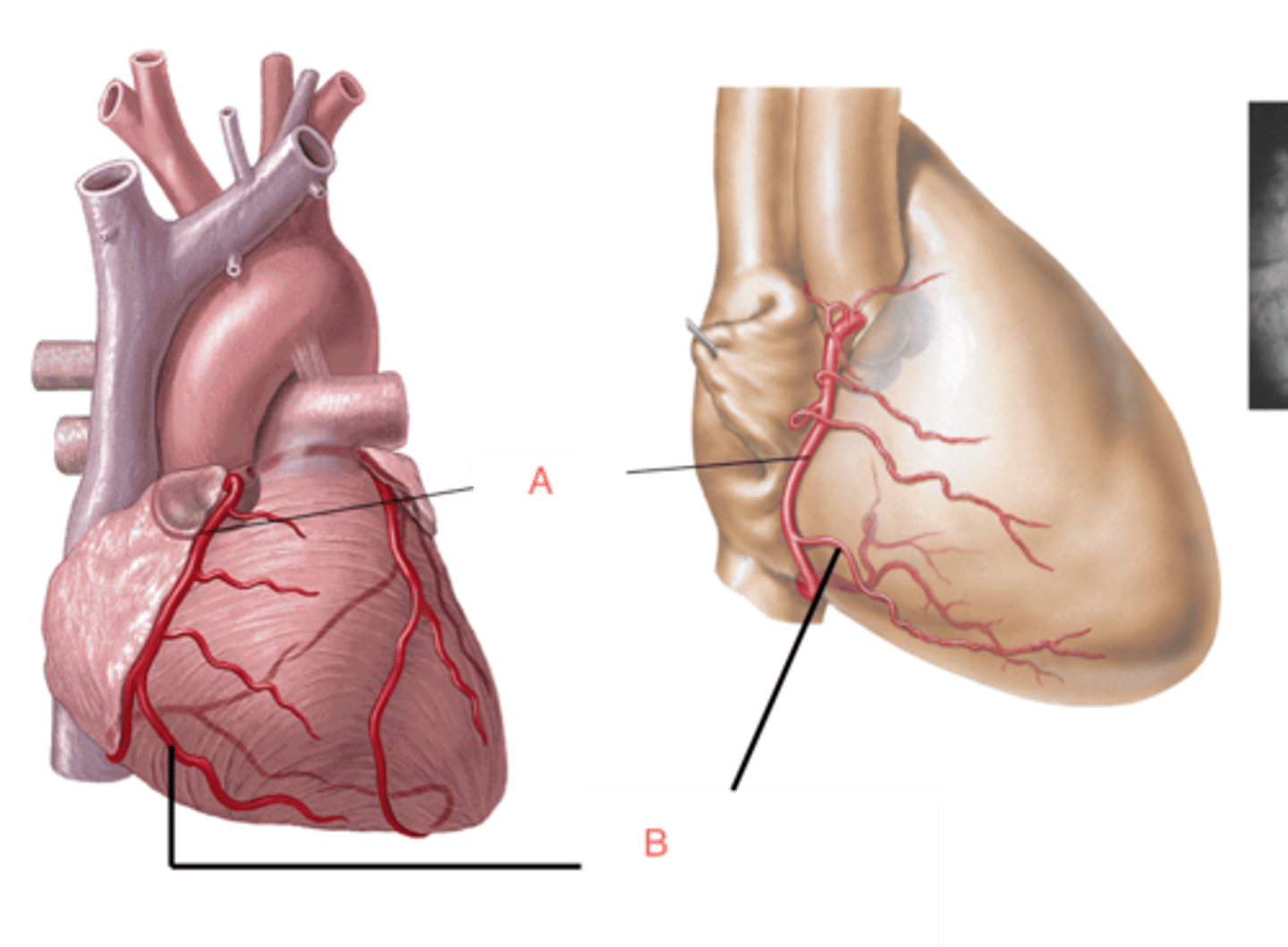 <p>A</p><p>supplies blood to the right atrium, right ventricle, bottom portion of the left ventricle and back of the septum</p>