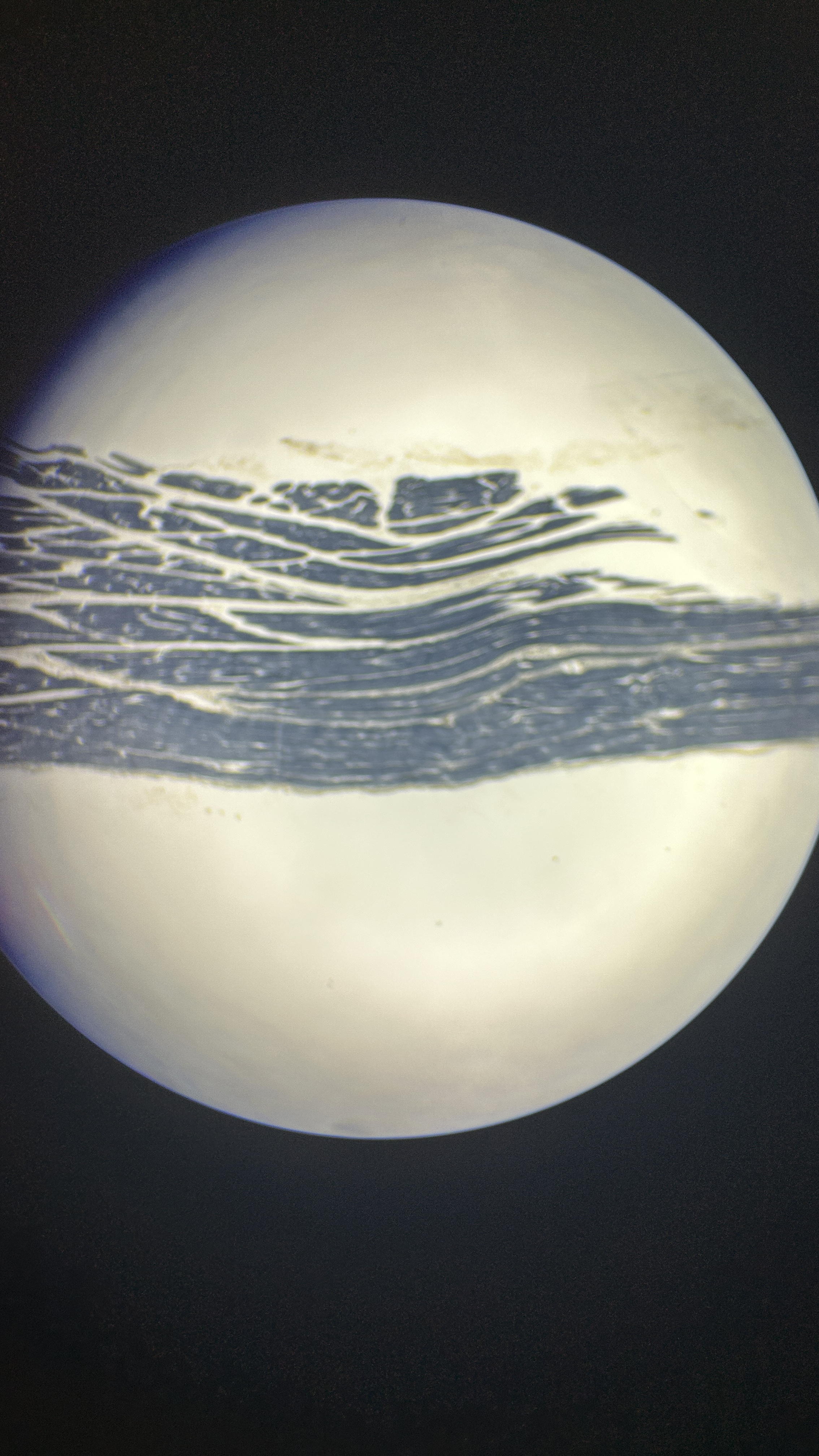 <p>What is the magnification level of the Skeletal Muscle?</p>