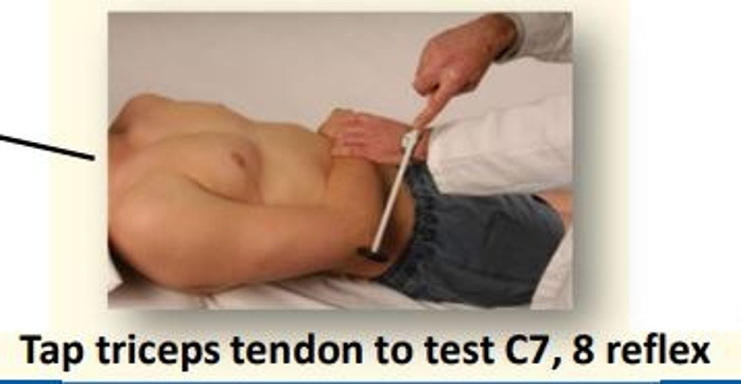 <p>Tap the triceps tendon</p>