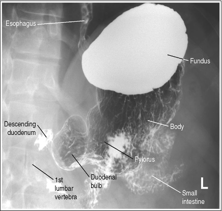 <p>What position is this patient in?</p>