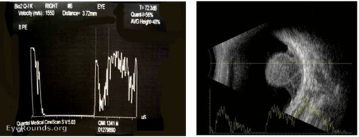 <p>Low internal reflectivity</p>