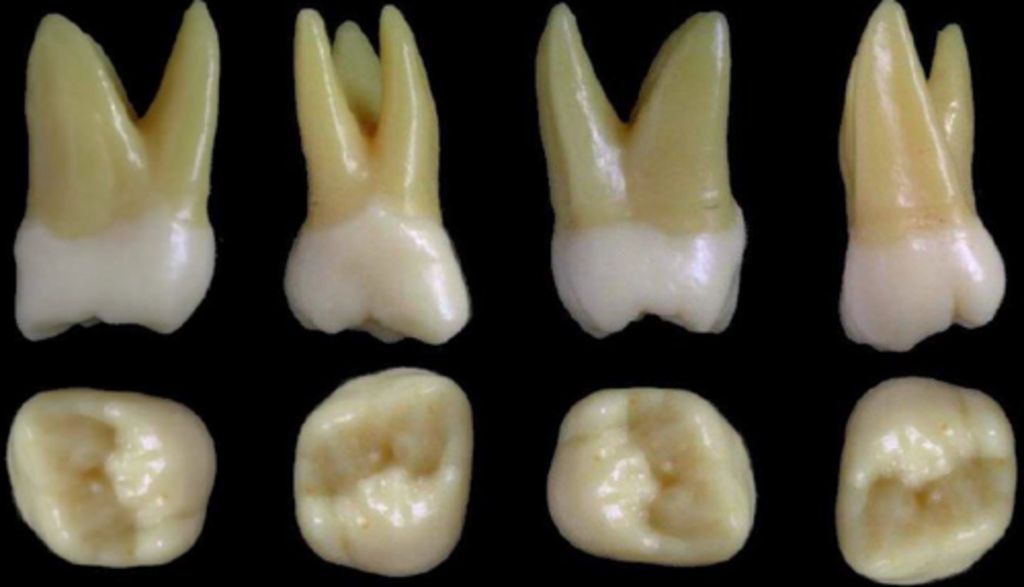 <p>what tooth is this &amp; why?</p>