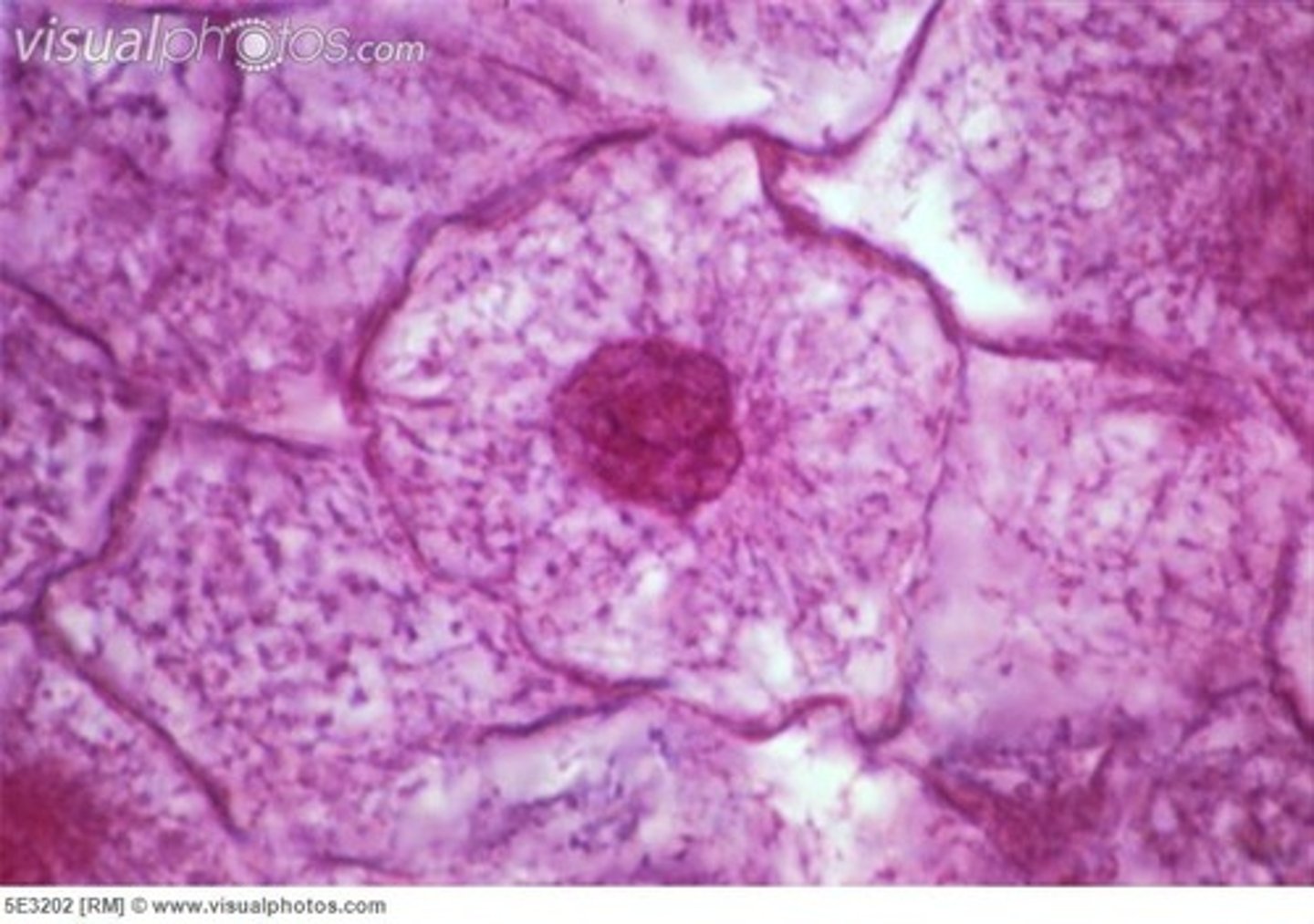 <p>nuclei are rounded or oval. Dna is in chromatin form, chromosomes are not present. Microtubles are distributed around the nucleus</p>