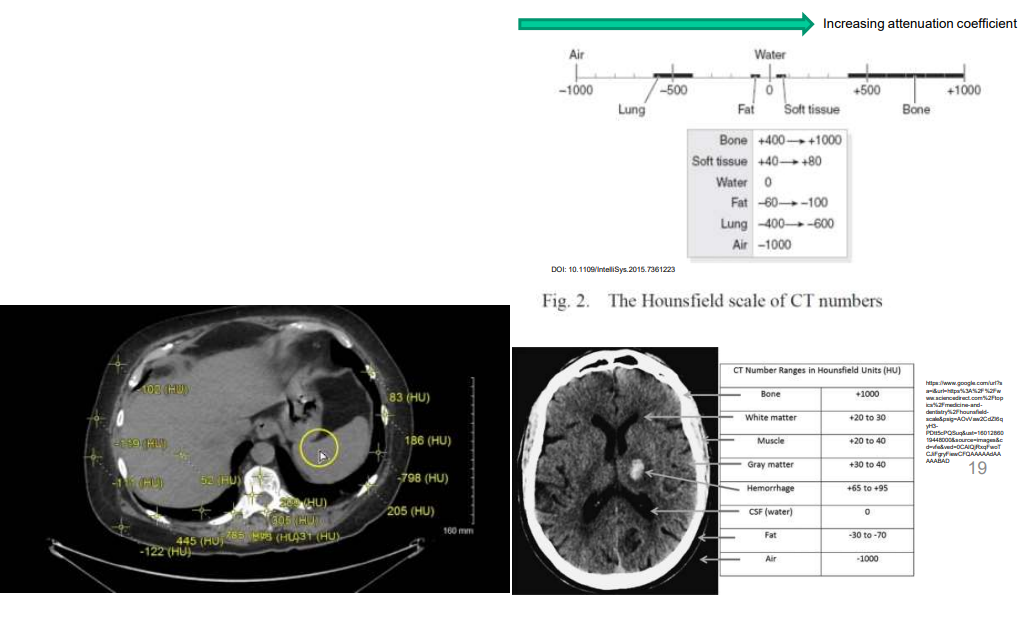 <ul><li><p>measure how much X-ray radiation is absorbed or scattered as it passes through a material</p></li><li><p>In CT imaging, these coefficients are used to calculate Hounsfield Units (HU)</p><ul><li><p>represents tissue density</p></li></ul></li><li><p>HU values help differentiate between various tissues</p></li></ul><p></p>