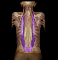<p>Bilateral action extends neck and vertebral column; unilateral action lateral flexes vertebral column.</p>