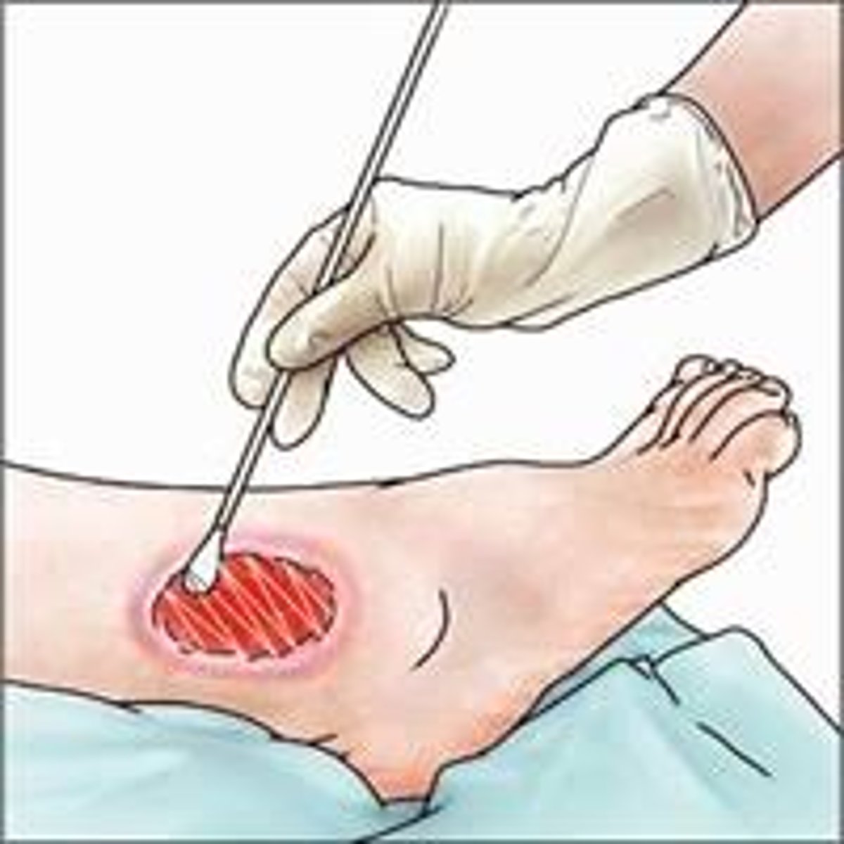 <p>a test to determine microbial presence (bacterial, viral, or fungal) that may cause an infection</p>