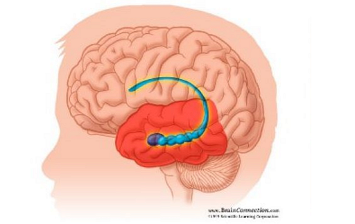 <p>what location in the brain is this?</p>