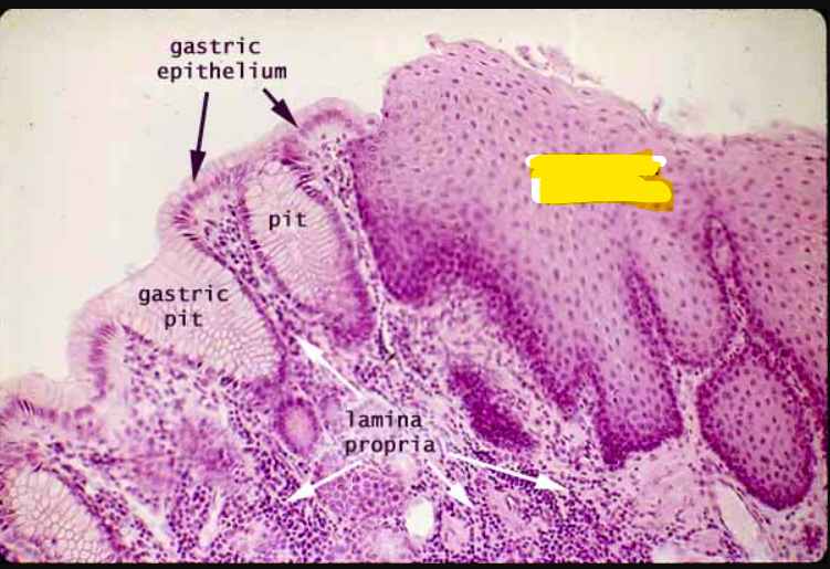 (of stomach)