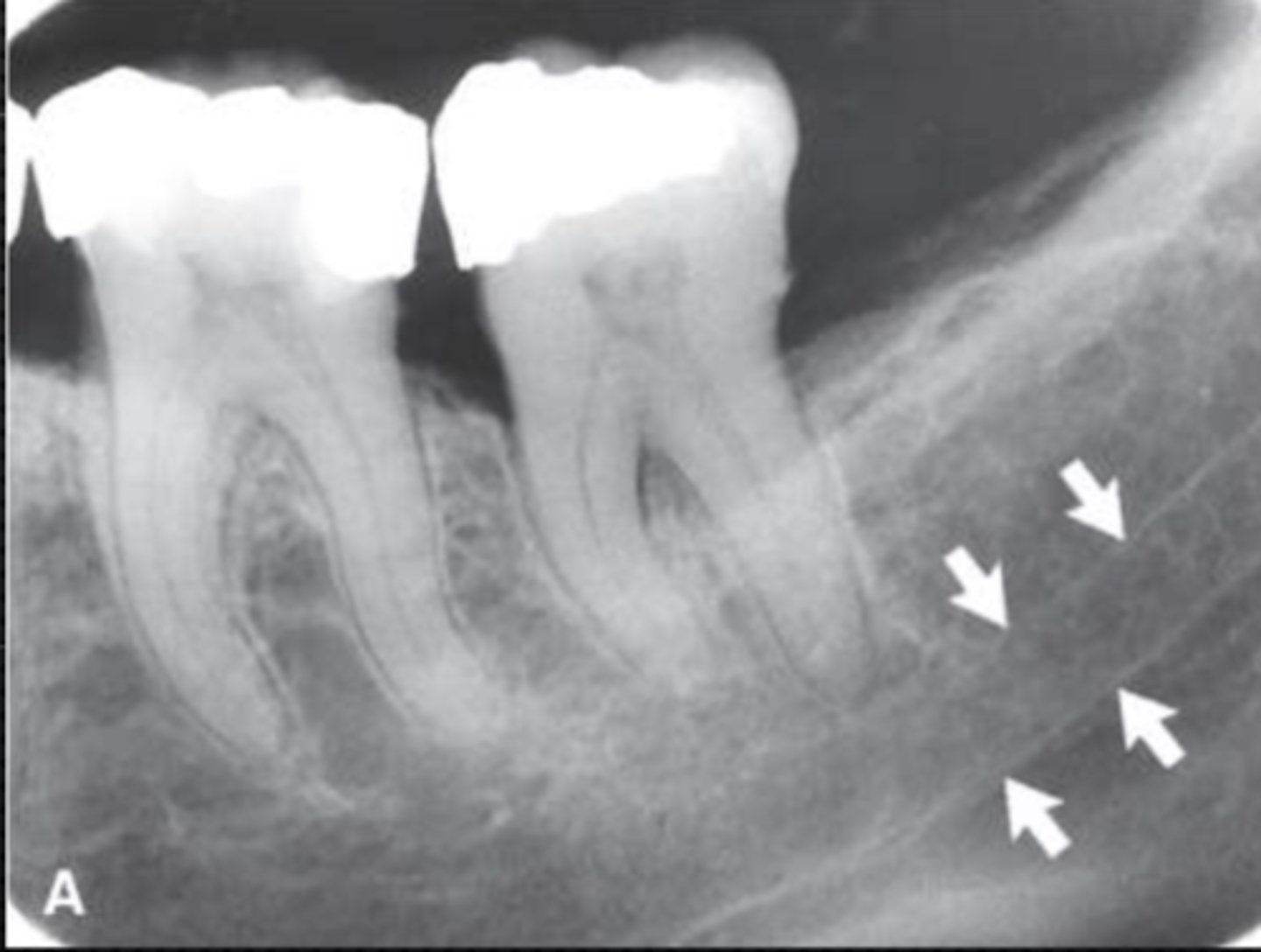 <p>Identify the structure</p>