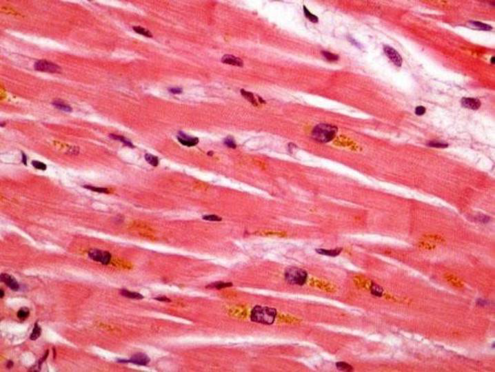 <p>Stain of Lipofuscin</p>