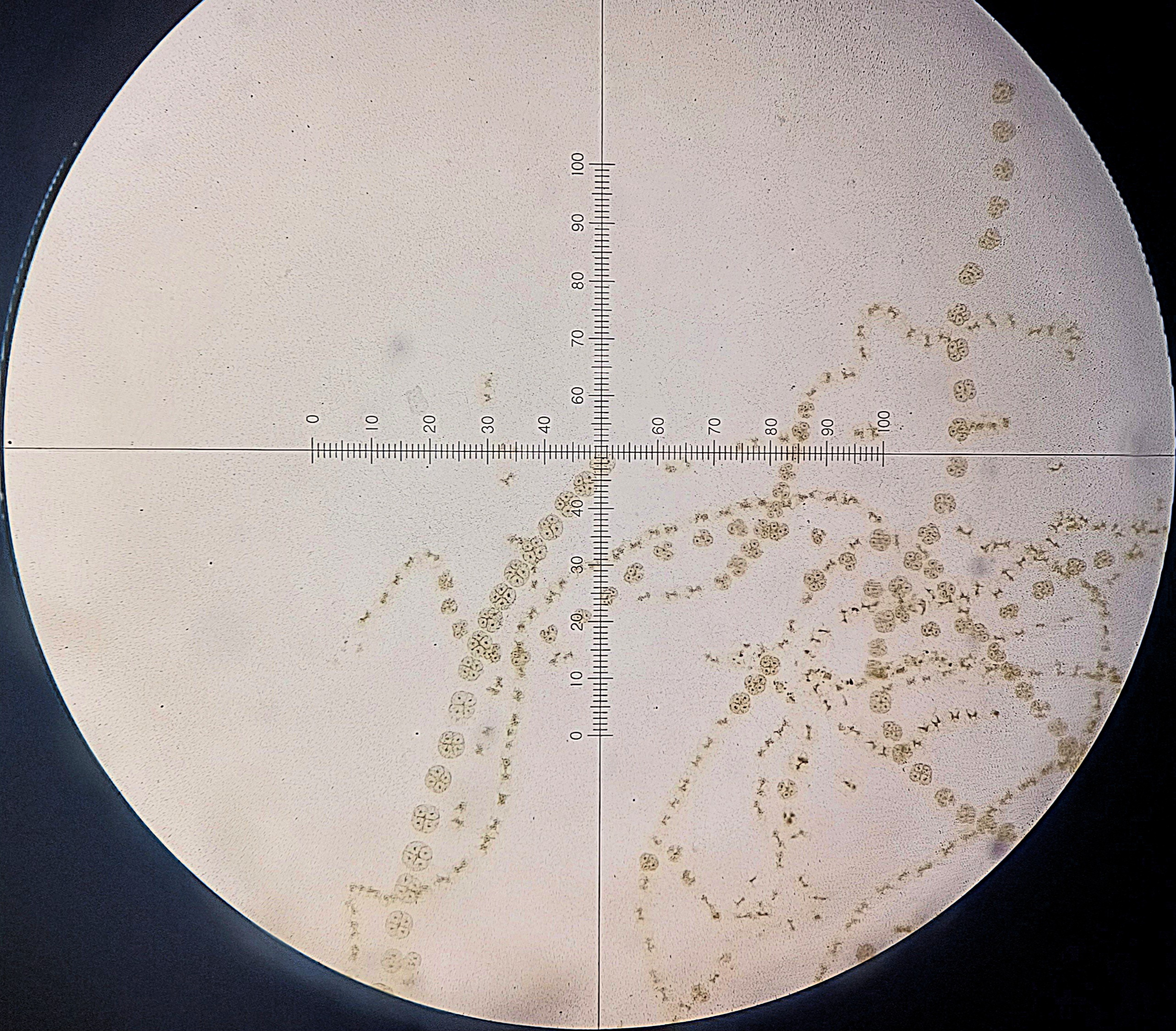 <p>Phylum: Charophyta</p><p><strong>Ecological Importance:</strong></p><ul><li><p>Acts as a primary producer in freshwater ecosystems, providing oxygen and forming the base of the aquatic food web.</p></li><li><p>Aids in nutrient cycling by absorbing excess nitrogen and phosphorus, thus reducing water pollution.</p></li></ul><p><strong>Economic Importance:</strong></p><ul><li><p>Used as a bioindicator for assessing water quality.</p></li><li><p>Has potential applications in wastewater treatment by absorbing pollutants.</p></li><li><p>Valuable for scientific research with applications in biotechnology, biofuel production, and environmental management.</p></li></ul><p></p>