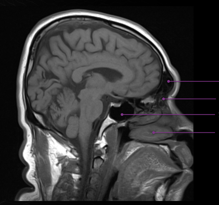 <p>4 sinus names</p>