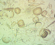 <p>name the protist and if auto or hetero</p>