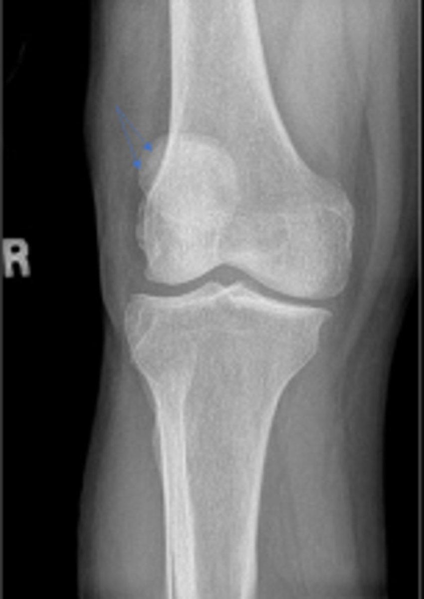 <p>What is outlined?</p>