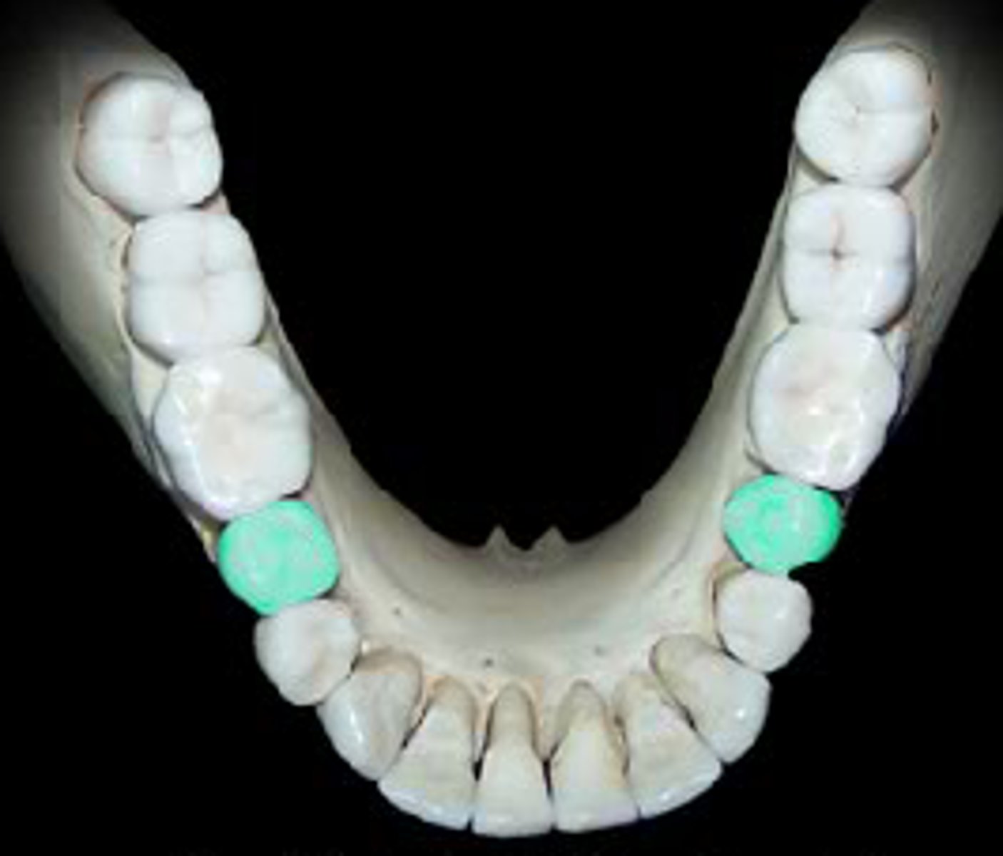 <p>name this</p>