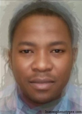 <p>Identify this Phenotype</p>