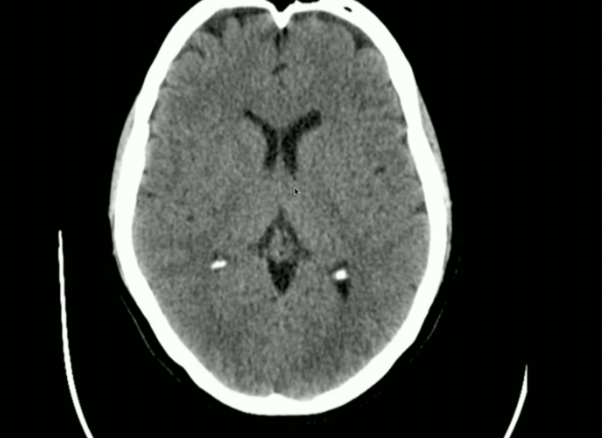 <p>Locate: Sulci, Grey Matter + White Matter</p>