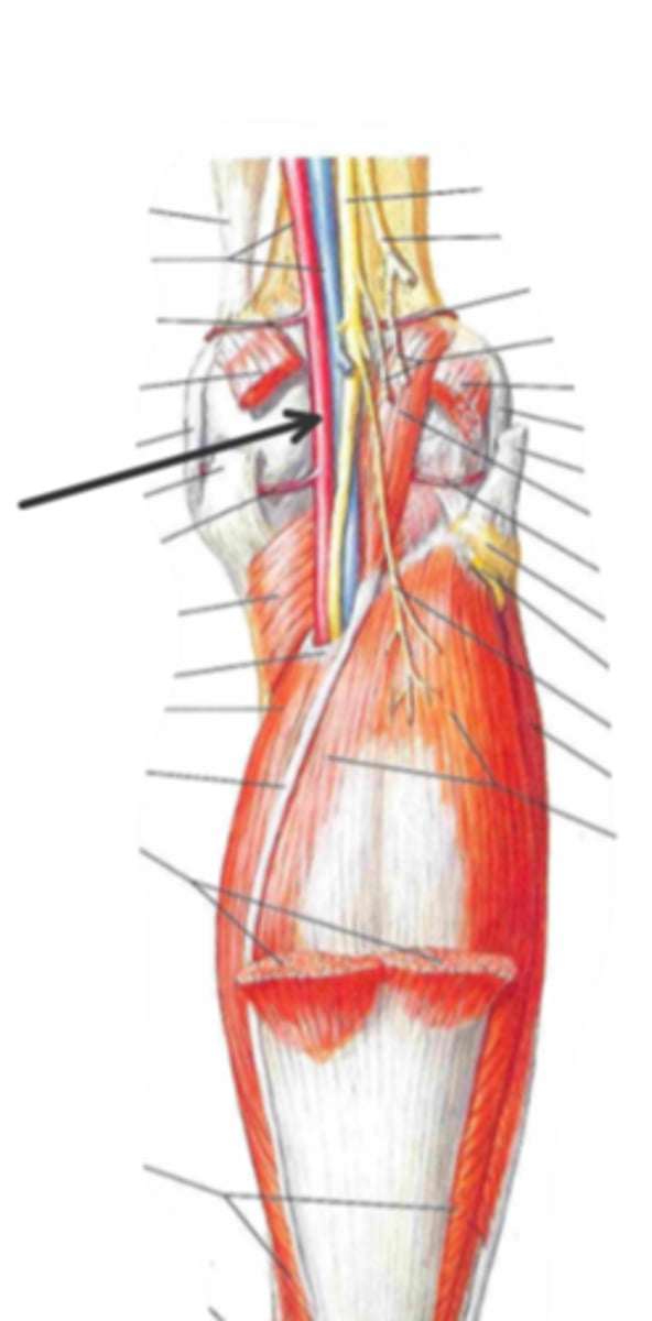 <p>identify the structure(s) indicated by the arrow</p>