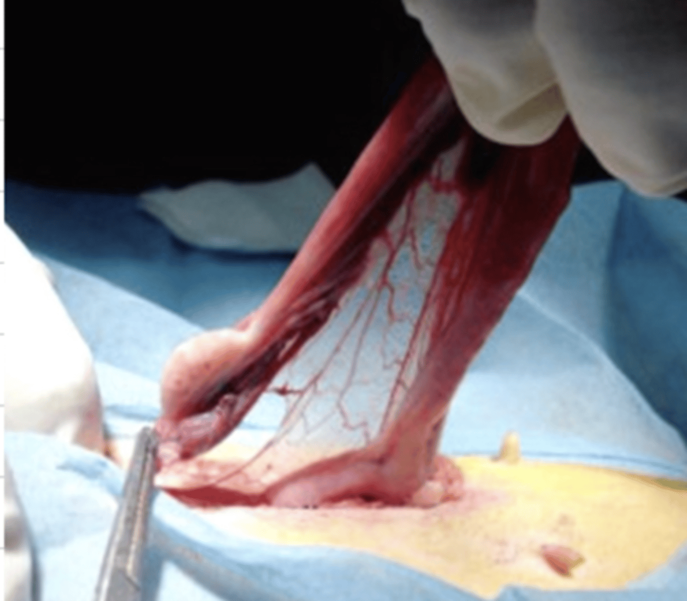 <p>what is the name for this operation?</p>