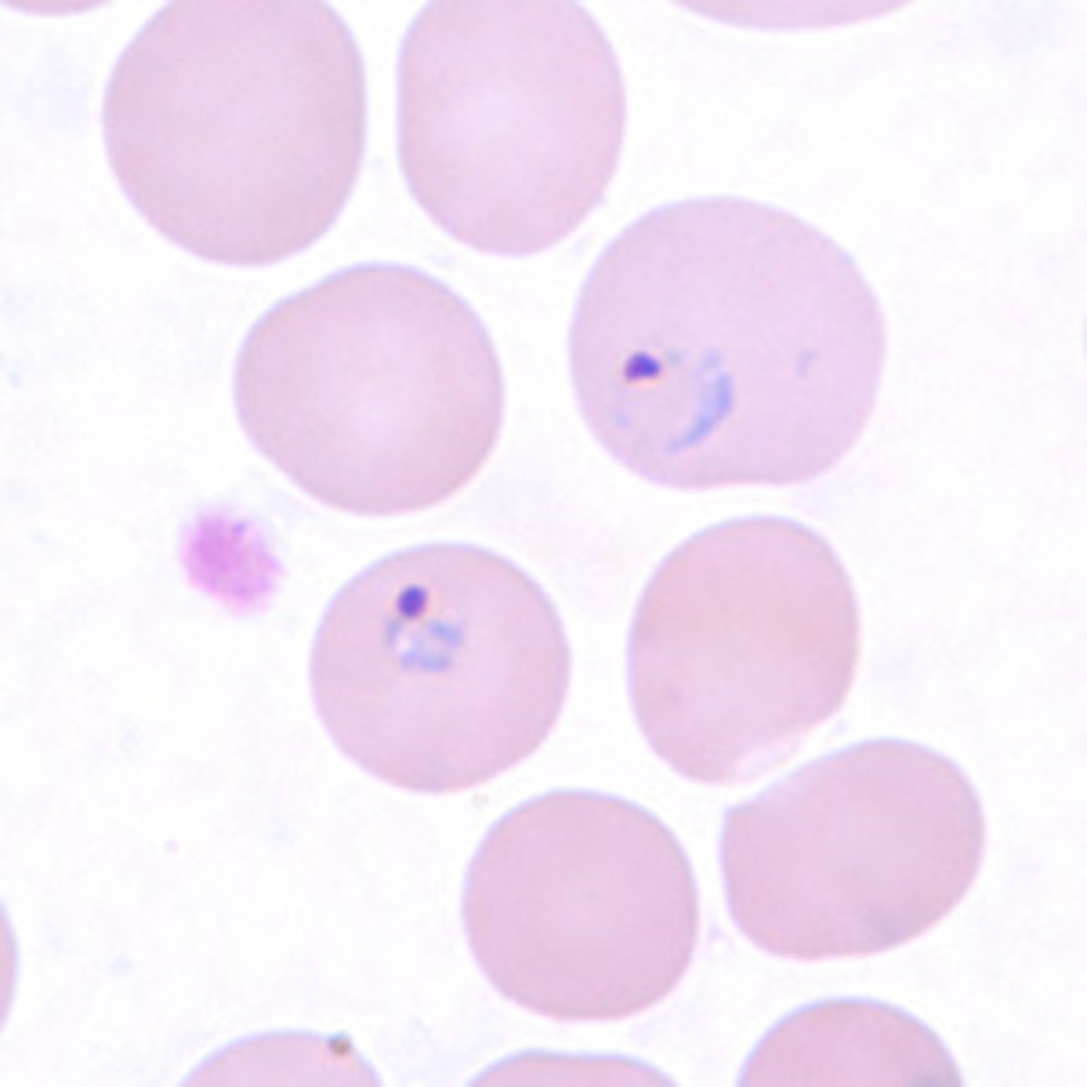 <p>*RBCs become enlarged when infected, may be distorted</p>