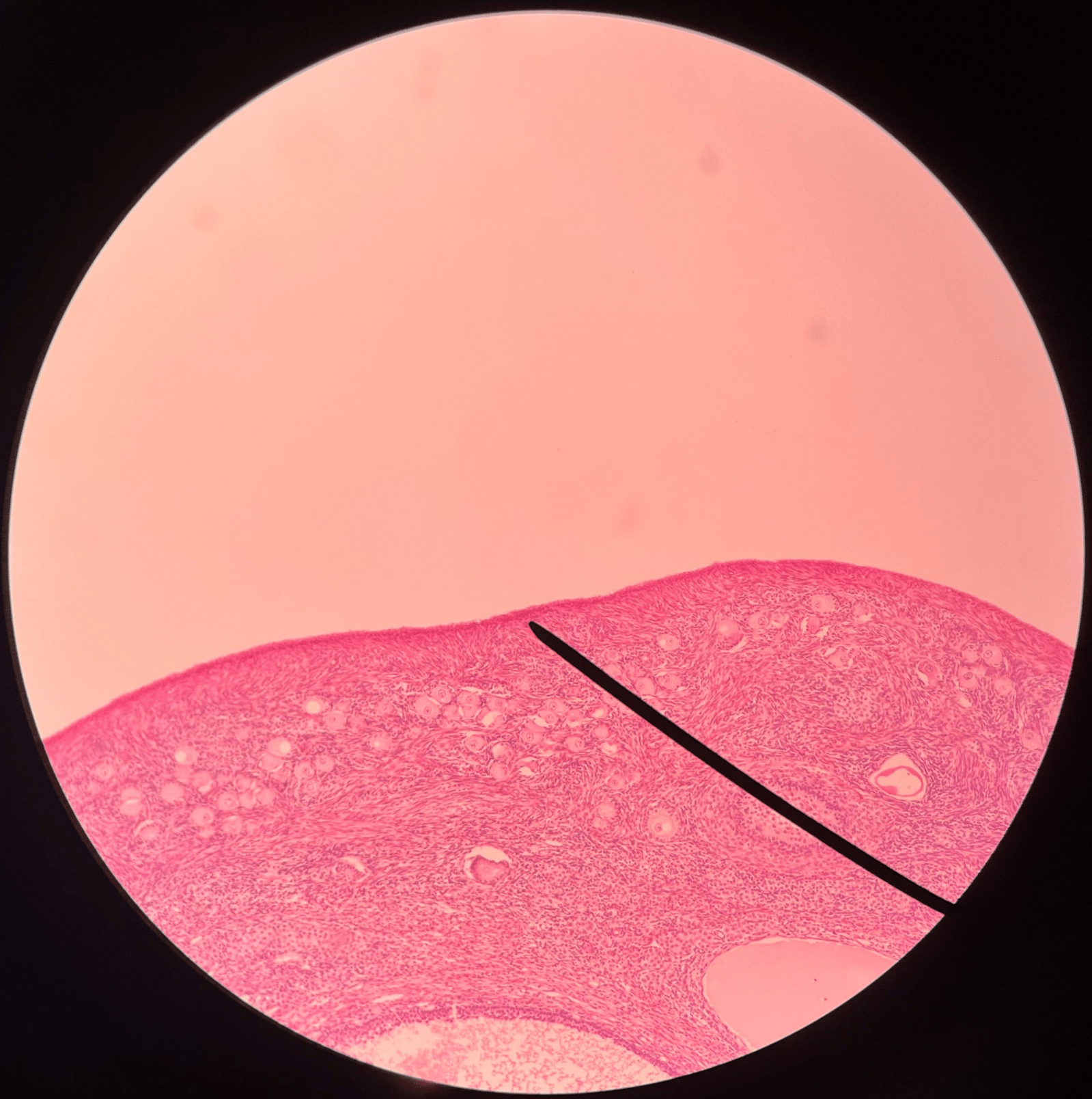 • Slide histology of the ovary.

• A fibrous layer internal to the germinal epithelium.