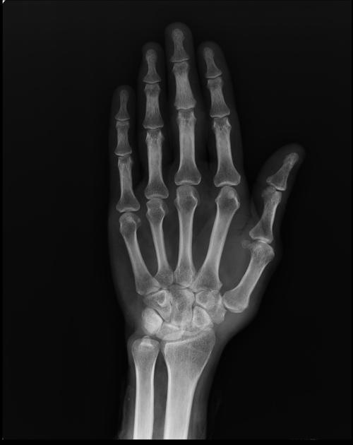 term image