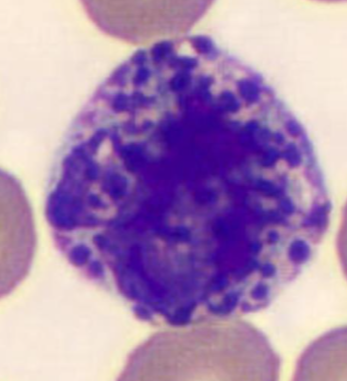 <p>what type of blood cell is this?</p>