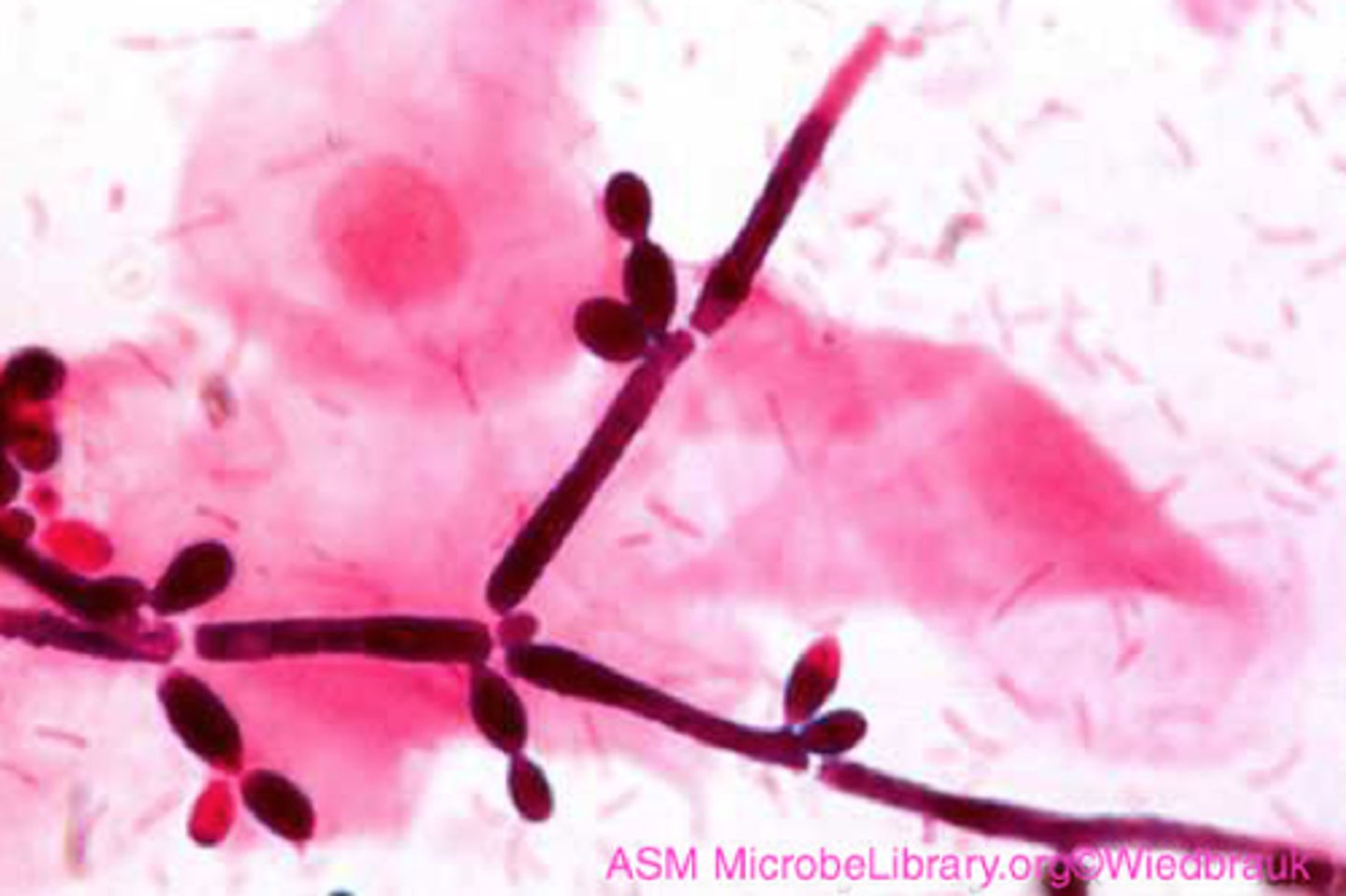 <p>Fungi, Thrush, diaper rash, "yeast" infections, systemic infections.</p>