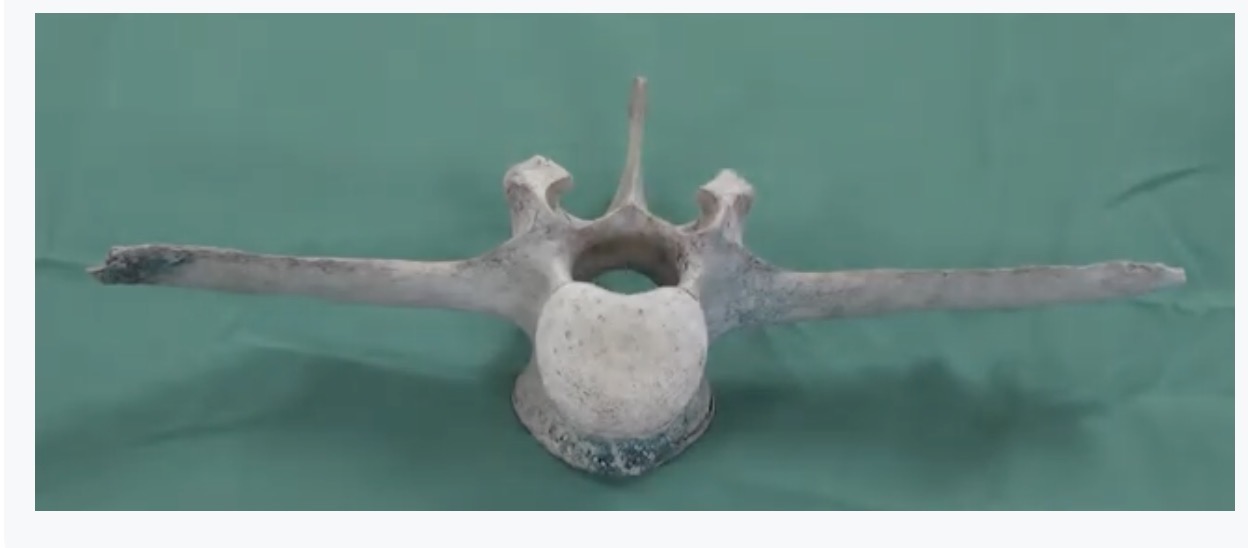 <p>Name the landmarks</p><img src="blob:null/9eb3ba78-4bd4-4e73-b848-5aaf2b7d5bf8"><p></p>