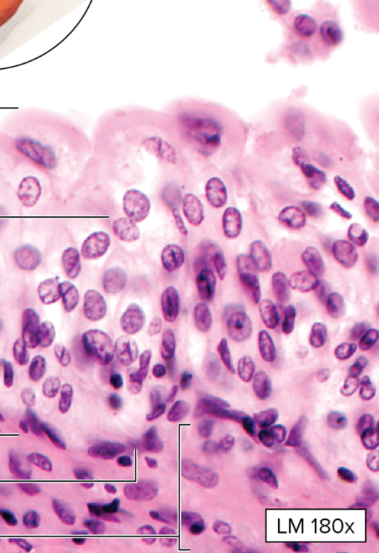 <p>What type of epithelial tissue is this?</p>