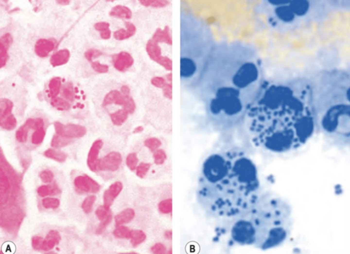 <p>- gram negative/methylene blue</p><p>- intracellular in WBCs</p><p>- diplococci</p>
