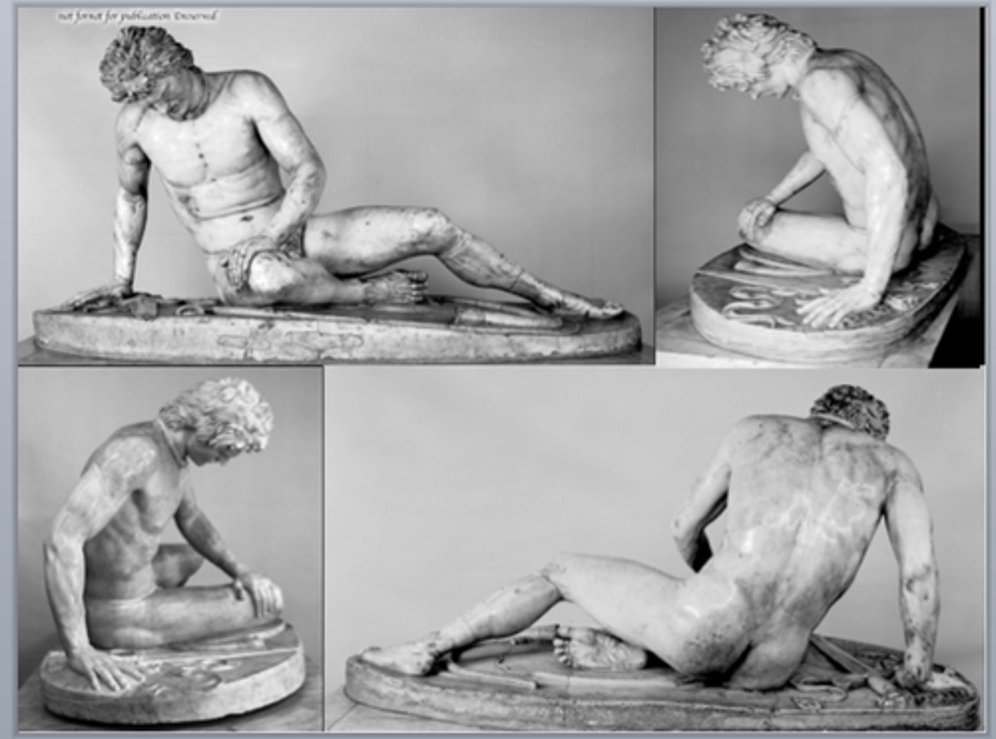 <p>- <span class="bgP">220 bce (high hellenistic pd)</span></p><p>- <span class="bgP">from Pergamon (where victory was against Gauls)</span></p><p>- <span class="bgP">made by Epigonus</span></p><p>- "dying gaul" (Gaul denoted by mustache)</p><p>- roman copy; part of bigger group of dedications known as the Large Gauls (included Gaul and his wife)</p><p>- man is trumpeter (broken trumpet on ground)</p>