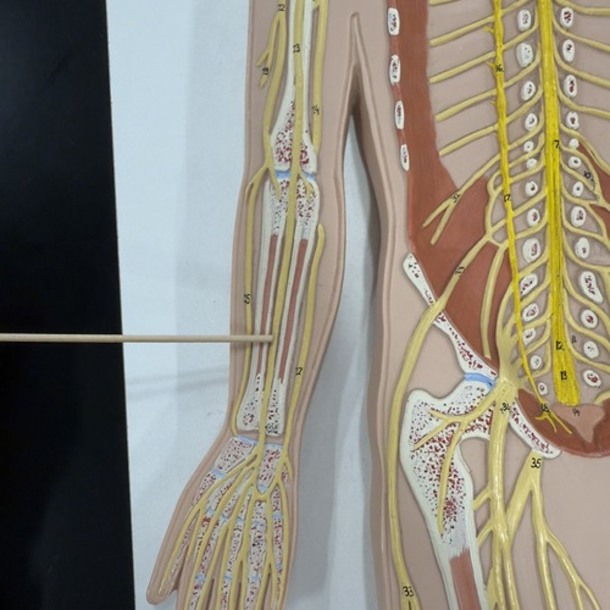 <p>Identify the nerve.</p>