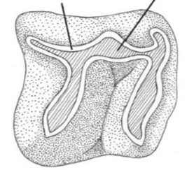 <p>What type of tooth is this?</p>