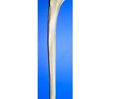 longest and thinnest forearm bone