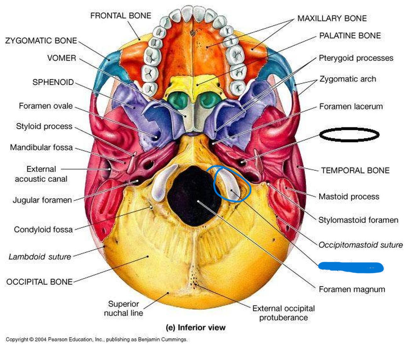 <p>What part of skull?</p>