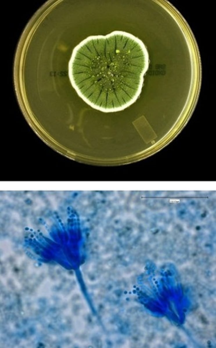 <p>• Usually a</p><p>contaminant, but can</p><p>cause infections</p><p>• Blue-green powdery</p><p>colonies with white</p><p>border</p><p>• "Skeleton hand"</p><p>phialide and conidia</p><p>arrangements</p>