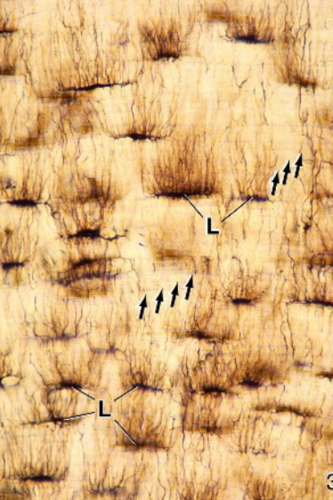 <p>What type of bone cell is this?</p>