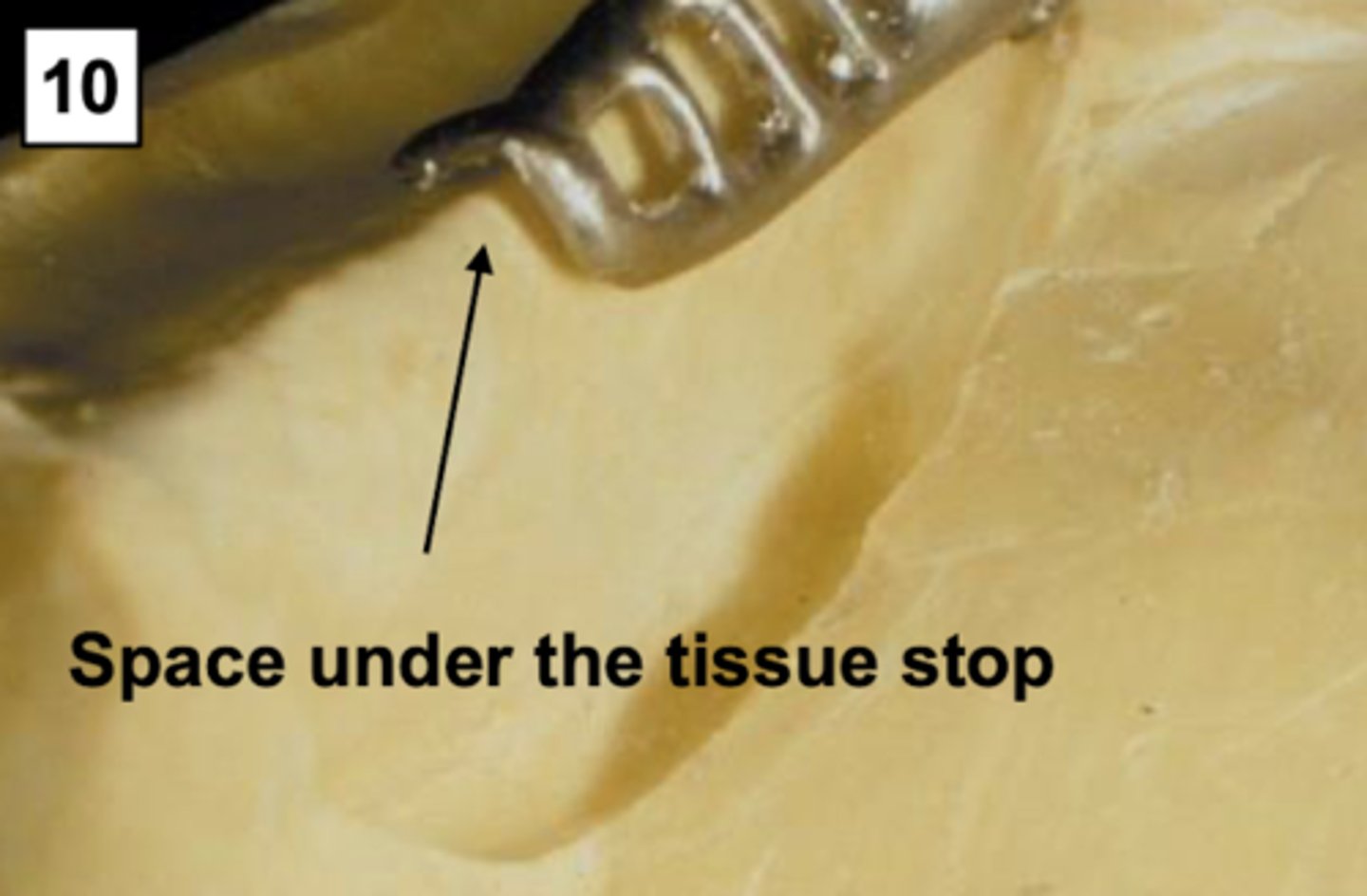 <p>Check the fit of the tissue stops. If there is space under the tissue stop, what should you do?</p>