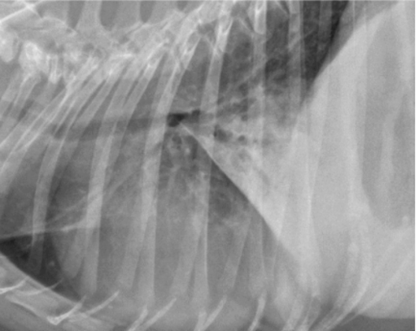 <p>What lung pattern is this?</p>