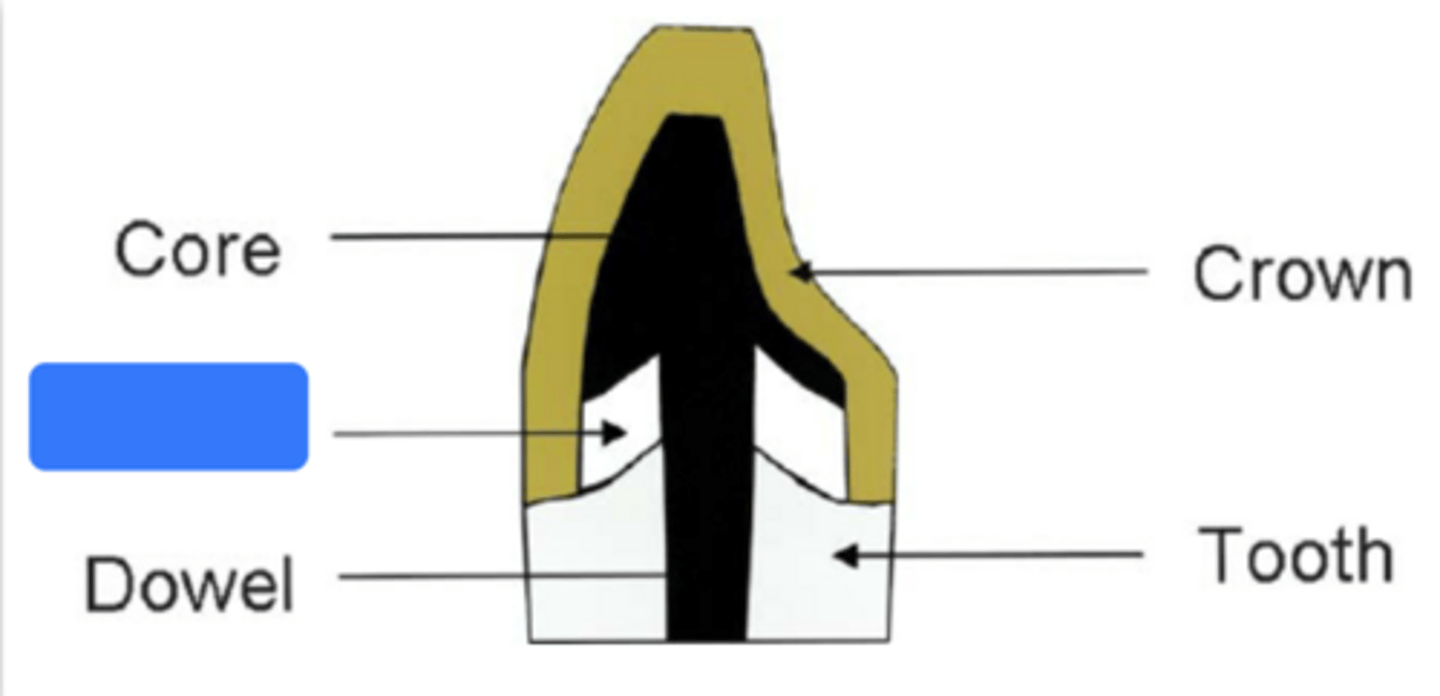 <p>What does the blue box indicate?</p>