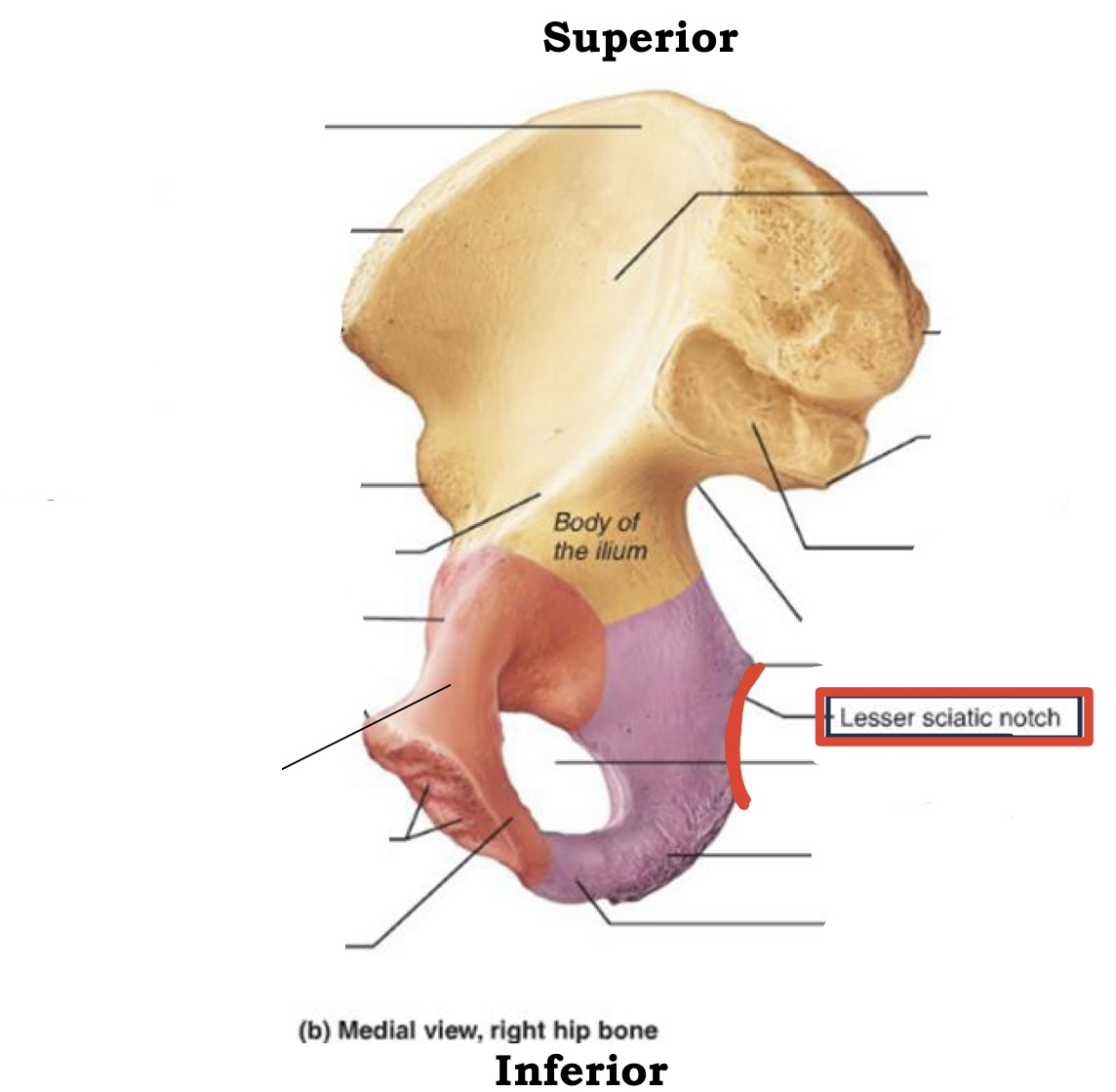 <p><span><span>Lesser Sciatic notch</span></span></p>