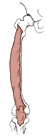 <p>Origin: <span>Anterior and lateral surface of the Femur</span></p><p>Insertion: <span>Patella</span></p><p>Action: <span>extends the leg</span></p>