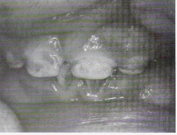 <p>Q: What is the primary cuticle?</p>