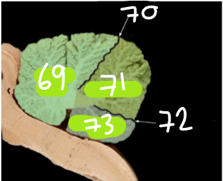 70