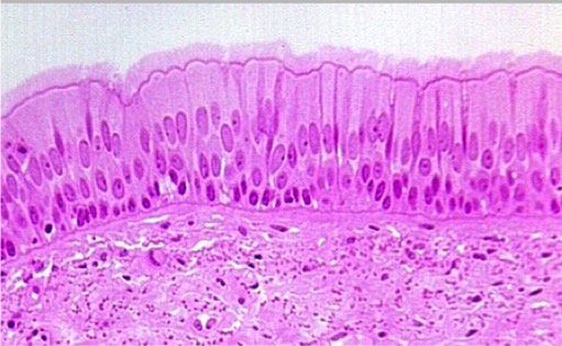 <p>Pseudo-Stratified Columnar Epithelium</p>